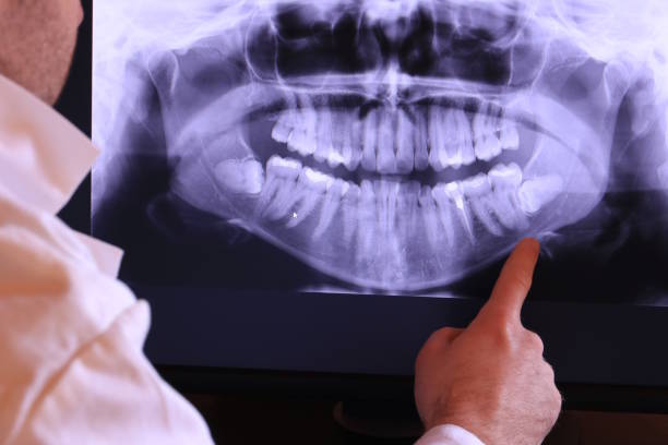 Best Broken or Chipped Tooth Repair in Montecito, CA